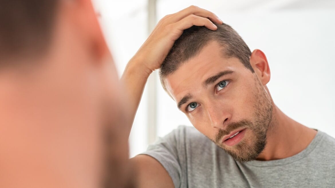 Trapianto capelli FUE DHI: Autotrapianto di capelli a singole unità follicolari