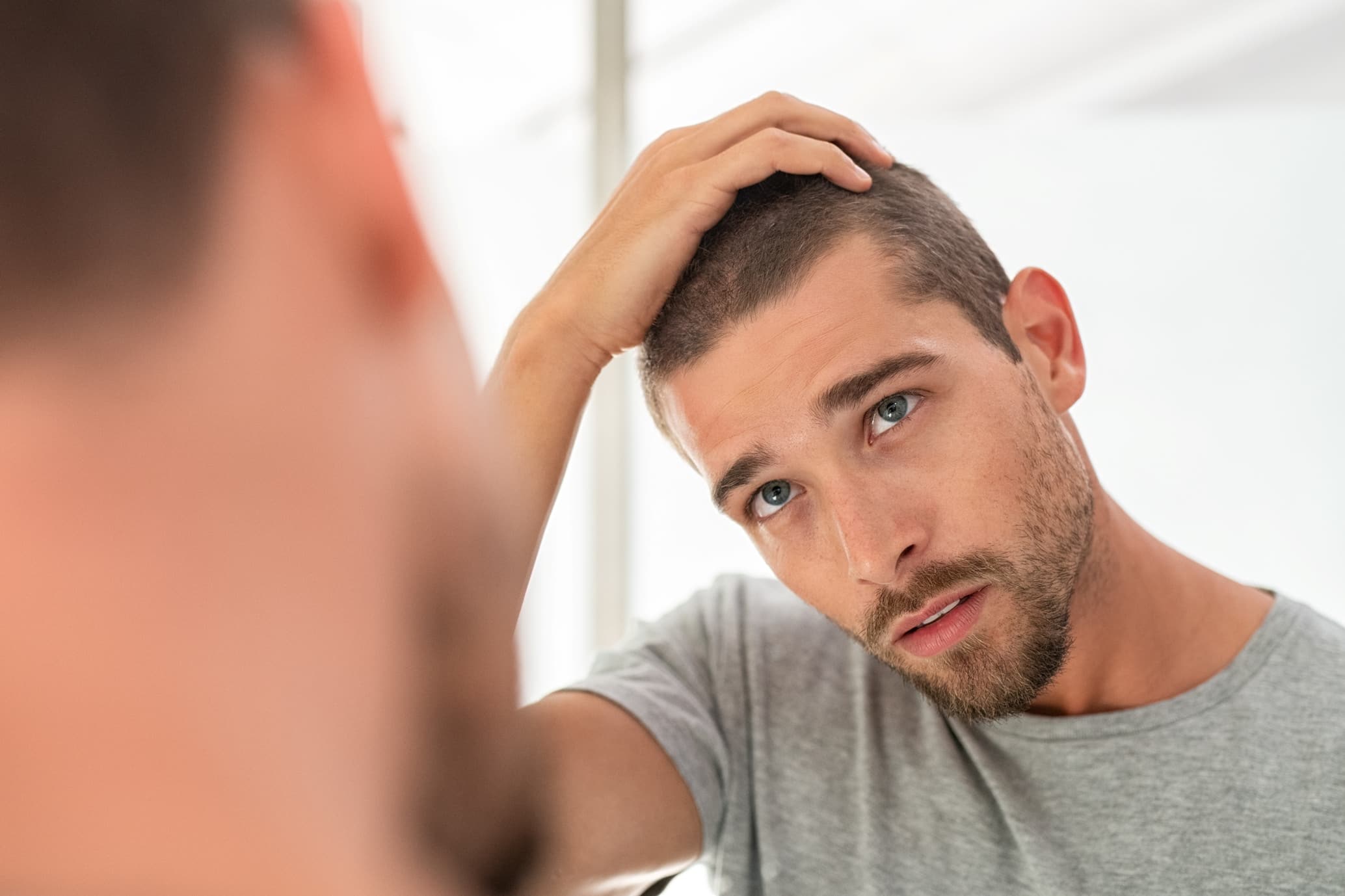 Autotrapianto capelli: consulenza e risultati