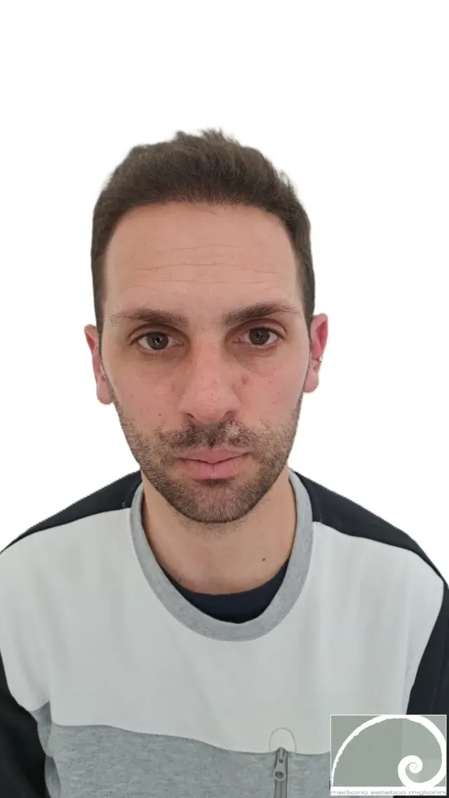 Dopo il trattamento
