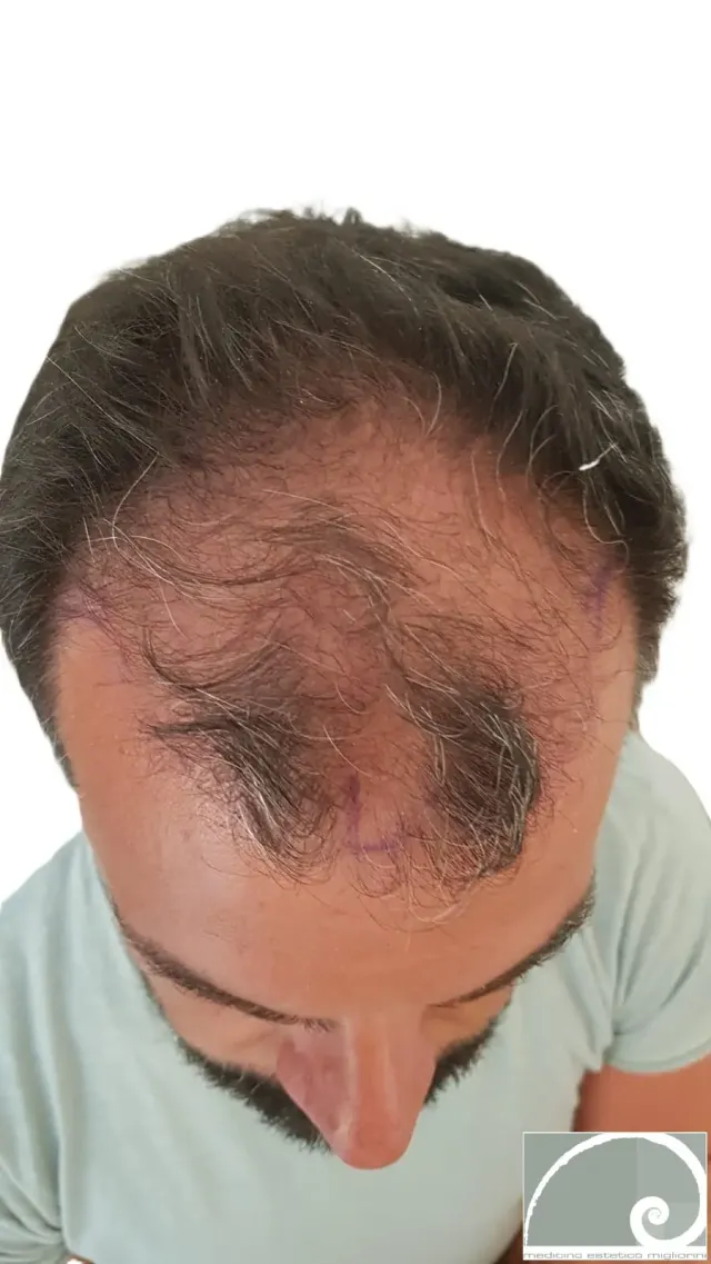 Prima del trattamento