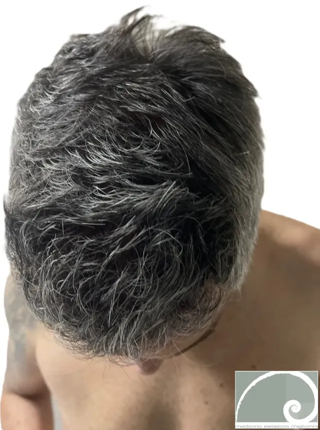 Dopo il trattamento