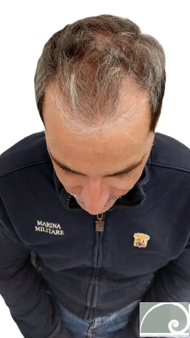 Prima del trattamento