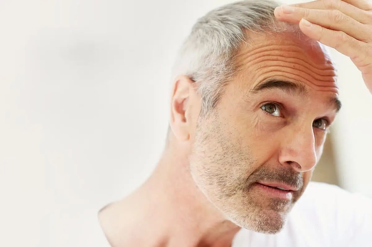 Quali tecniche usiamo per il trapianto 6 medicina estetica migliorini autotrapianto capelli slide 1